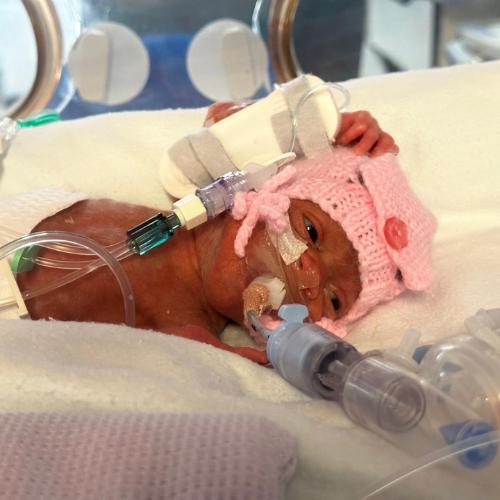 10 meaningful ways to support World Prematurity Month